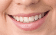 gesunde Zähne gesundes Lächeln